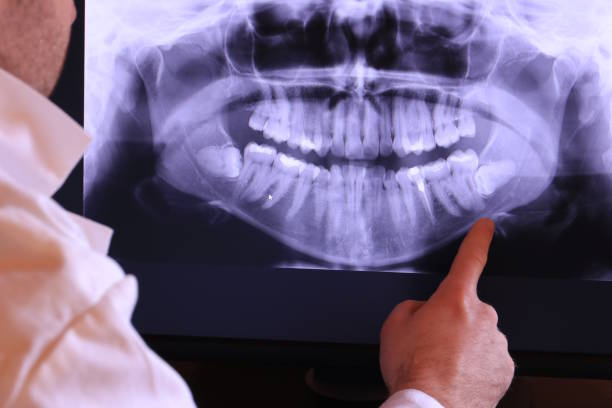 Best Emergency Treatment for Dental Infections or Abscesses in Dyer, TN